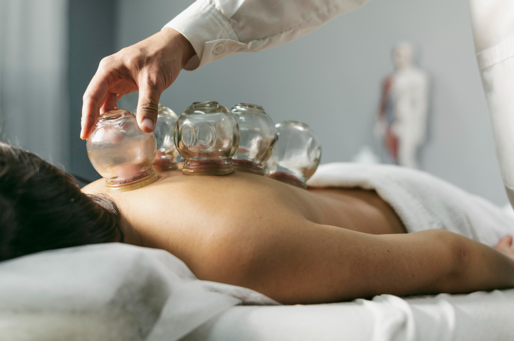 Cupping Therapy Cupping Therapy